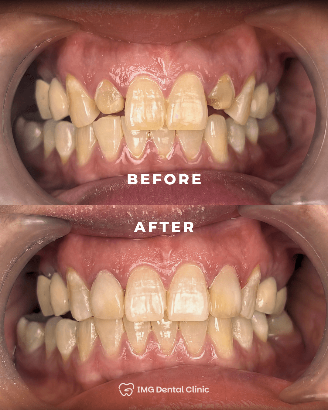 Before & After 2