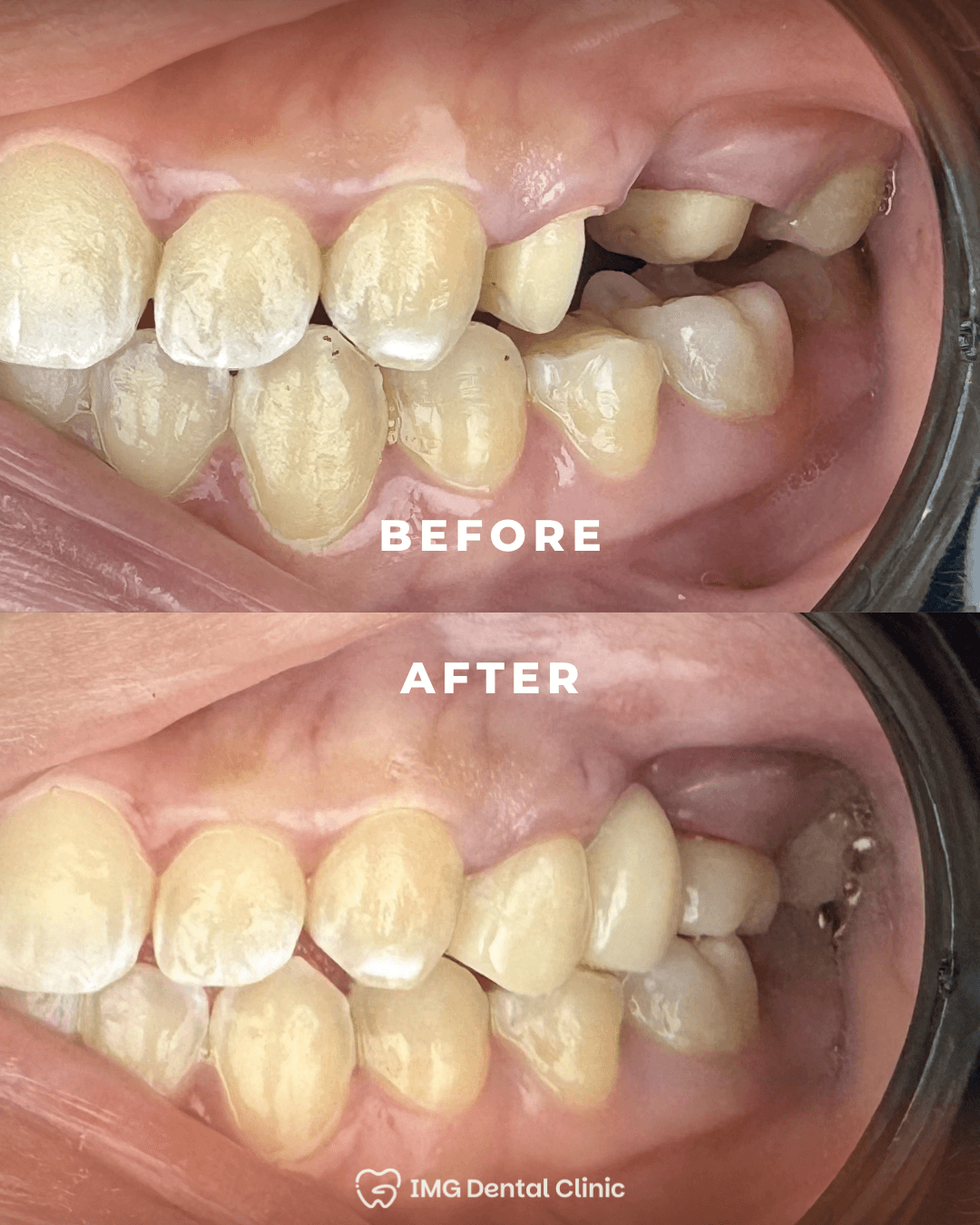 Before & After 3