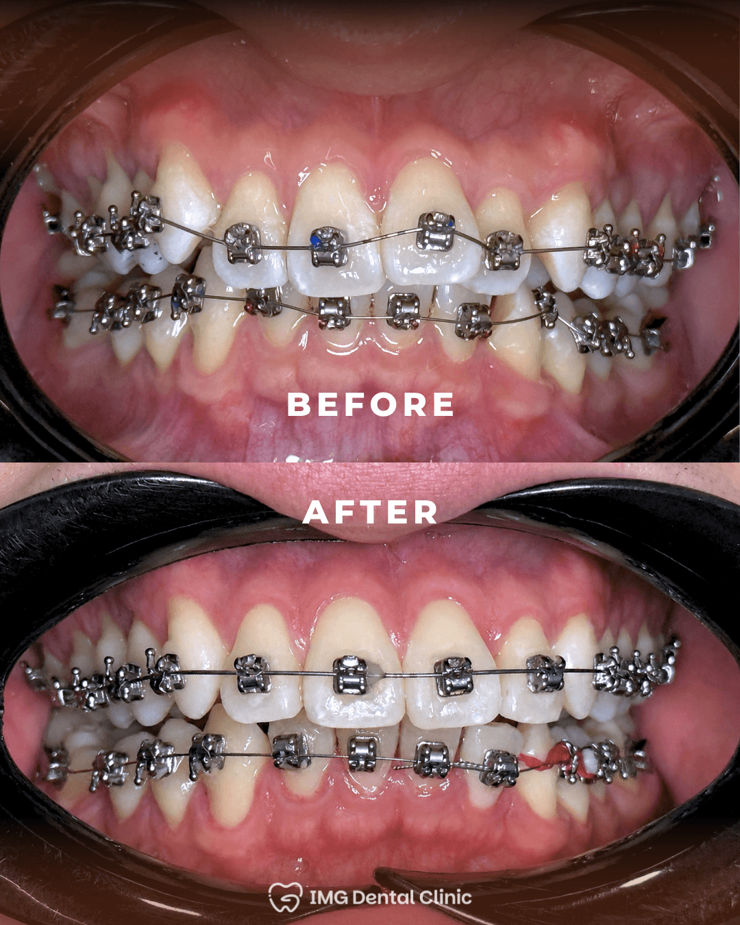Before & After 4