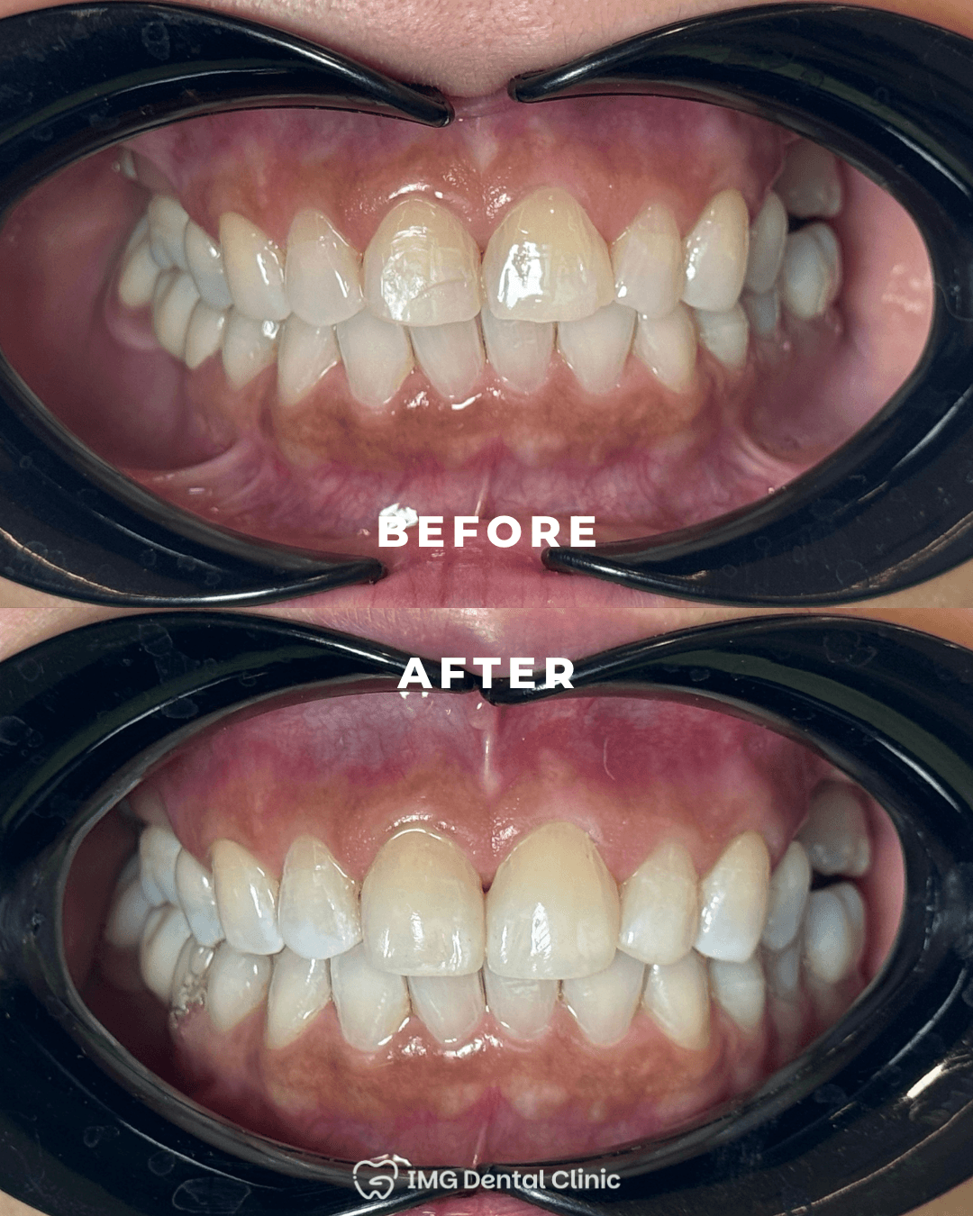 Before & After 5